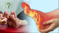 Burning Sensation In Feet At Night Causes And Home Remedies In Tamil