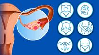 Early Warning Signs Of Ovarian Cancer In Tamil