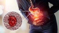 Potential Causes Of Stomach Ulcer In Tamil