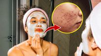 வெயிலால் முகத்தில் பிம்பிள் அதிகமா வருதா? இந்த ஃபேஸ் பேக்கை போடுங்க போயிடும்...