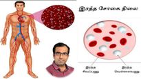 இரத்த சோகை குணமாக எந்த மாதிரியான உணவை சாப்பிட வேண்டும் - டாக்டர் ஃபரூக் கூறும் அட்வைஸ்!