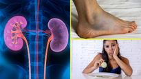 இந்த அறிகுறிகள் உங்ககிட்ட இருக்கா? அப்ப உங்க சிறுநீரகம் பெரிய ஆபத்தில் இருக்காம்... உயிருக்கே பாதிப்பாம்!