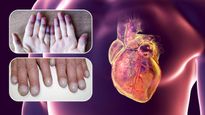 எச்சரிக்கை! உங்க கை மற்றும் கால்களில் இந்த அறிகுறிகள் இருக்கா? அப்ப உங்க இதயம் ஆபத்தில் இருக்காம்!