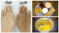 உங்க கை கருப்பா இருக்கா? ஒரே வாரத்தில் உங்க கைகள் வெள்ளையாகணுமா? அப்ப இந்த மாதிரி செய்யுங்க...