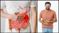 பெருங்குடல் புற்றுநோய் வரப்போகுதுன்னா.. இந்த 4 அறிகுறியும் 2 வருஷத்துக்கு முன்னாடியே தெரிய ஆரம்பிக்குமாம்..