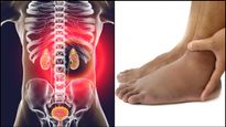 கால்களில் இந்த அறிகுறிகள் தெரியுதா? அப்ப சிறுநீரக நோய் இருக்கு-ன்னு அர்த்தம்.. உஷார்...