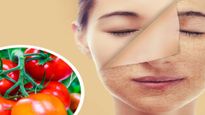 Tomato for skin: தக்காளியை சருமத்தில் இப்படி யூஸ் பண்ணுனா உங்க சருமம் தங்கம் மாதிரி ஜொலிக்குமாம்...!