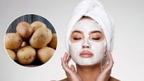 சருமத்தை தங்கம் ஜொலிக்க வைக்க உதவும் உருளைகிழங்கு பேஸ் பேக்... எப்படி செய்யணும் தெரியுமா?