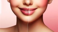 Home Remedies To Remove Upper Lips Darkness In Tamil