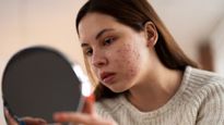 Skin Care Tips Top 10 Homemade Natural Face Packs For Oily And Acne Free Skin