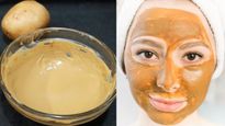 Skin Care Tips How To Use Potato To Get A Clear And Bright Skin