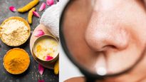 Top 5 Diy Face Scrubs To Get Rid Of Blackheads At Home