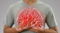 World Lung Cancer Day 2025 Doctor Lists Top 5 Warning Symptoms Of Lung Cancer
