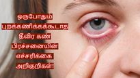 உங்க கண்களில் இந்த 5 அறிகுறிகள் தெரியுதா? அப்ப உடனே டாக்டர்கிட்ட போங்க.. எச்சரிக்கும் கண் மருத்துவர்!