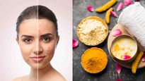Skin Care Tips Top 5 Diy Face Packs To Remove Acne Scars