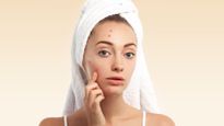 Skin Care Tips Top 8 Best Diy Face Packs For Pimples And Acne Prone Skin
