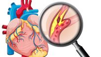 Homemade Syrup To Cure Heart Blockage In Tamil