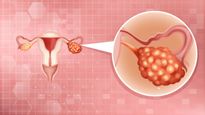 Early Warning Signs Of Ovarian Cancer In Tamil