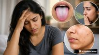 Unhealthy Body Symptoms Doctor Shares 7 Signs Your Body May Be Unhealthy