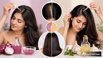 Onion Juice Vs Garlic Oil Which Is Better For Hair Growth