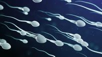 Doctor Explains Sperm Color And What Each Shade Means For Male Fertility