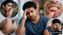 Fitness Coach Shares 7 Weird Signs Your Body Is Unhealthy