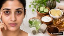 Top 5 Diy Under Eye Masks To Remove Dark Circles
