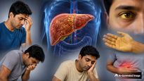 World Hepatitis Day 2026: இந்த அறிகுறி இருந்தா அசால்ட்டா இருக்காதீங்க.. அது ஹெபடைடிஸின் எச்சரிக்கை அறிகுறி!