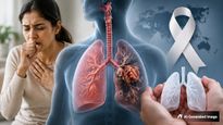 World Lung Cancer Day 2026: அலட்சியம் செய்யக்கூடாத நுரையீரல் புற்றுநோயின் ஆரம்ப அறிகுறிகளை பகிர்ந்த டாக்டர்!