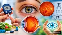 World Sight Day 2026: சுகர் இருக்கா? அப்ப கண் பிரச்சனையை அசால்ட்டா விடாதீங்க.. எச்சரிக்கும் கண் டாக்டர்!