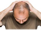జుట్టు ఊడిపోవడానికి గల 10 ప్రధాన కారణాలు..!