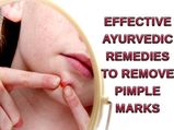 మొటిమలను పూర్తీగా మాయం చేసే.. ఎఫెక్టివ్ ఆయుర్వేదిక్ రెమిడీస్..