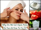 ముఖంలో అసహ్యంగా కనిపించే చర్మ రంద్రాలను నివారించడానికి ఎఫెక్టివ్ హోం రెమెడీస్..