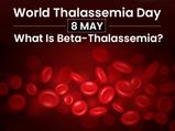 ప్రపంచ తలసేమియా దినోత్సవం 2020: తలసేమియా, రకాలు మరియు చికిత్స, సంకేతాలు మరియు లక్షణాలు