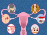 PCOSతో లావుబడడం? ఈ వ్యాధితో మహిళలు ప్రభావితం కారా? దాని లక్షణాలు మరియు చికిత్స చూడండి
