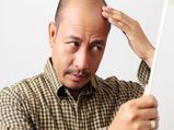 Male Pattern Baldness: నెత్తి మీద చాలా జుట్టు ఊడుతోందా? దానికి సంబంధించిన లక్షణాలు మీకు తెలుసా?