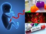 బొడ్డు తాడు రక్తంతో HIV రోగానికి చికిత్స : స్పష్టం చేసిన వైద్యులు..