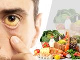 Diet for Jaundice: పచ్చకామెర్లు త్వరగా తగ్గాలంటే ఈ ఆహారపు అలవాటును అలవర్చుకోవాలి