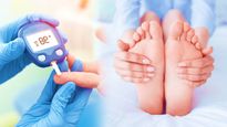 మీకు మధుమేహం ఉందో లేదో మీ పాదాలను చూసి తెలుసుకోవచ్చు..