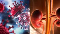 H3N2 Influenza: H3N2 వైరస్‌తో కిడ్నీలపై తీవ్ర ప్రభావం!