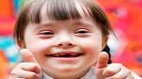 World Down Syndrome Day: డౌన్ సిండ్రోమ్‌తో పుట్టిన పిల్లల సమస్య ప్రపంచవ్యాప్తంగా కనిపిస్తుంది.