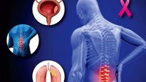 Cancer Symptoms:వెన్నునొప్పి తరచూ బాధిస్తోందా?క్యాన్సర్ అయ్యుండవచ్చు జాగ్రత్త ఎక్కువరోజులైతే వైద్యుడిని కలవండి