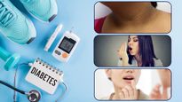 Diabetes: మీ శరీరంలో ఈ మార్పులు ఉంటే మీ బ్లడ్ షుగర్ లెవెల్ ఎక్కువే!