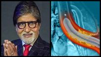 అమితాబ్ బచ్చన్ కు అస్వస్థత, యాంజియోప్లాస్టీ చేసిన వైద్యులు, యాంజియోప్లాస్టి అంటే ఏమి? ఎందుకు చేస్తారు