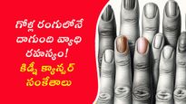 జాగ్రత్త మీ గోళ్లలో ఈ మార్పులు కనబడితే, అది క్యాన్సర్ సంకేతం కావచ్చు!
