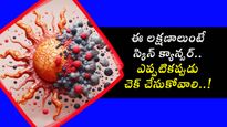 ఈ లక్షణాలుంటే స్కిన్ క్యాన్సర్.. ఎప్పటికప్పుడు చెక్ చేసుకోవాలి..!