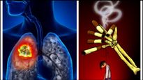 World Lung Cancer Day 2024: స్మోకింగ్ కాకుండా మీ ఊపిరితిత్తులకు హాని కలిగించే అంశాలు