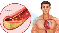కొలెస్ట్రాక్ ప్రాబ్లమ్ కి వంటగదిలోనే మెడిసిన్..తెలిస్తే ఆశ్చర్చపోవాల్సిందే