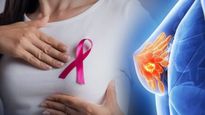 Breast Cancer Vaccine: మహిళలకు భారీ శుభవార్త...బ్రెస్ట్ క్యాన్సర్ ను మొగ్గలోనే తుంచేసే వ్యాక్సిన్!