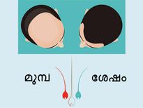 മുടി കൊഴിച്ചിലിന്റെ അന്തകന്‍ വീട്ടിലുണ്ട്